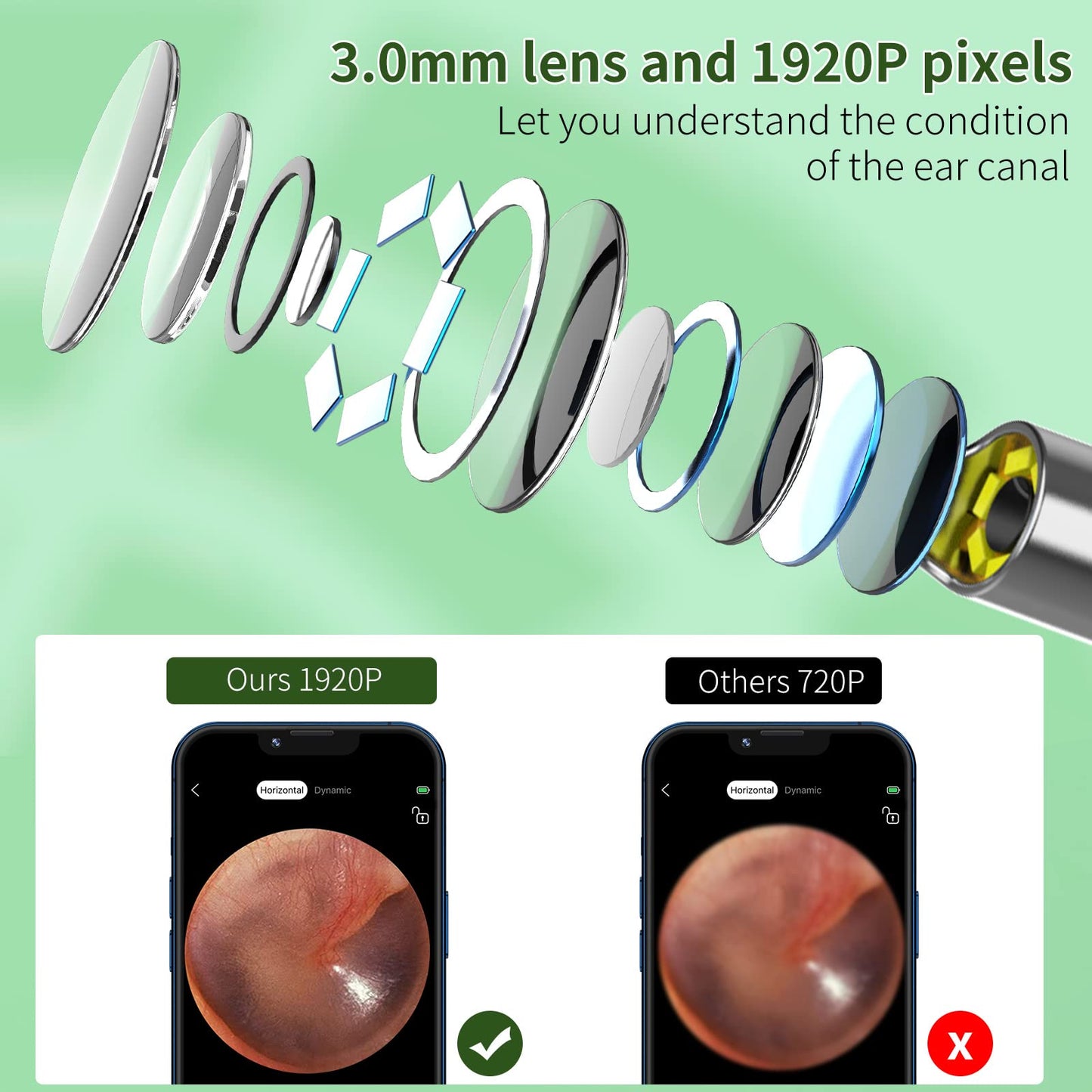 VITCOCO Ear Wax Removal Kit with 1920P HD Camera – Visual Ear Cleaner Otoscope with 6 LED Lights, 3mm Lens, Ear Cleaning Tool for iPhone, iPad & Android