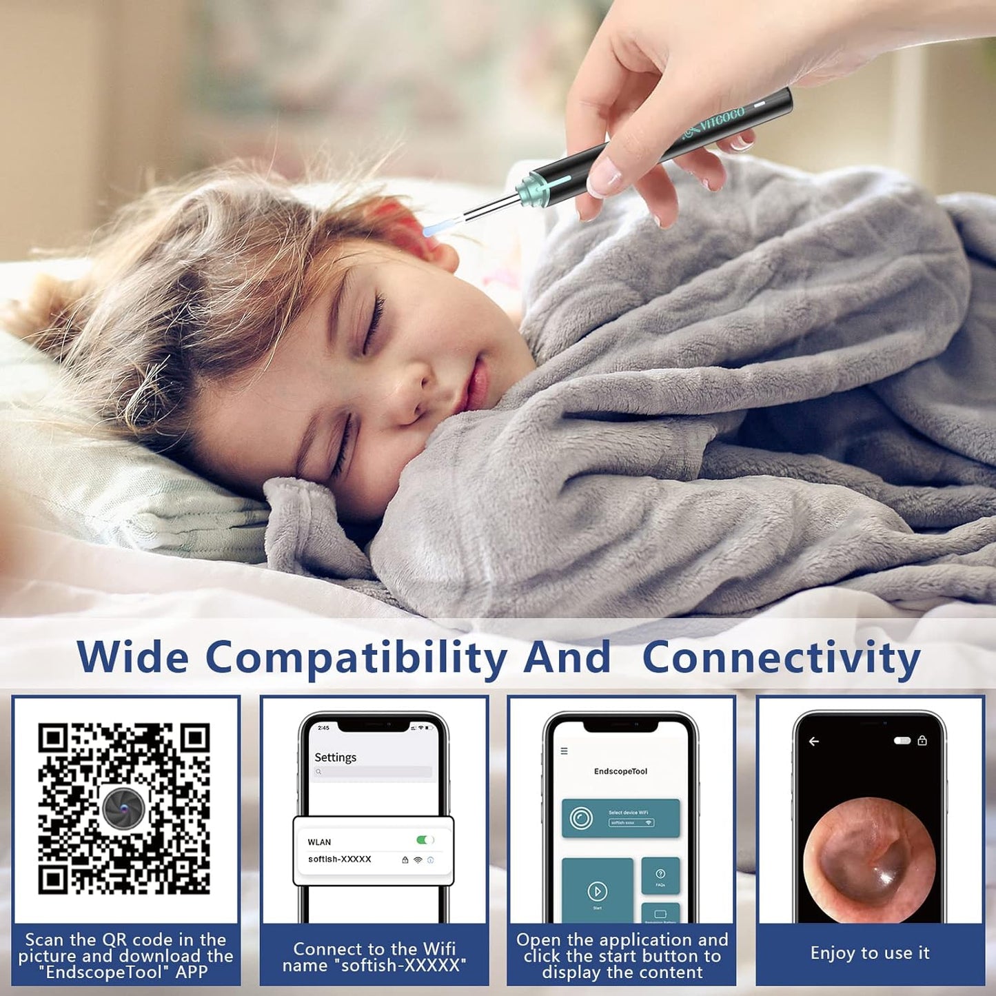 VITCOCO Wireless Ear Wax Removal Kit with 1920P FHD Camera, Waterproof Otoscope & 8PCS Ear Spoons
