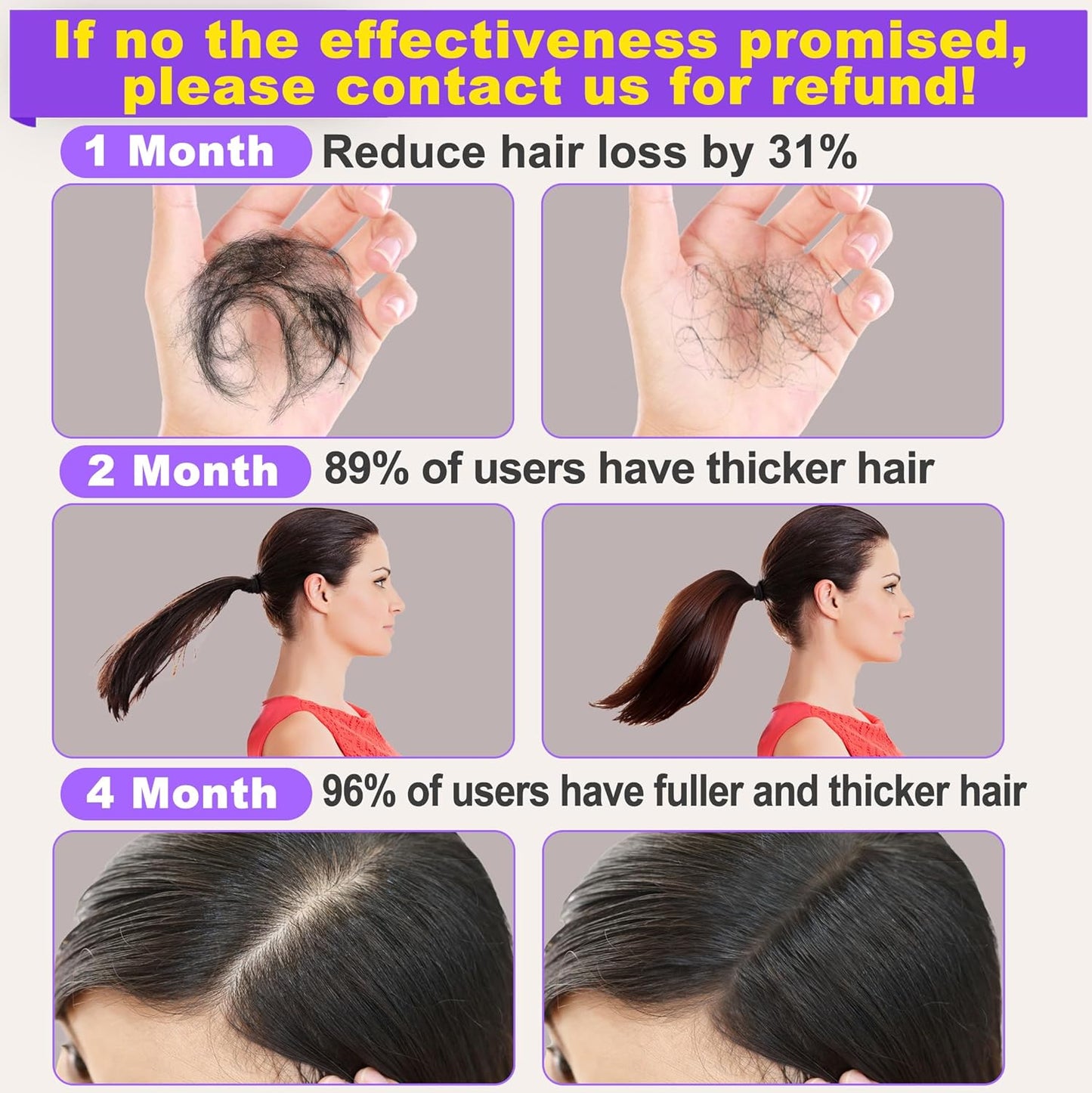 Rosemary Oil for Hair Growth,Diluted Rosemary Oil with Sclap Massager&Ebook,Hair Growth Oil Serum with Castor Oil Biotin Argan Oil for Dry Damaged Hair,Hair Ingrown Loss Treatments for Women Men