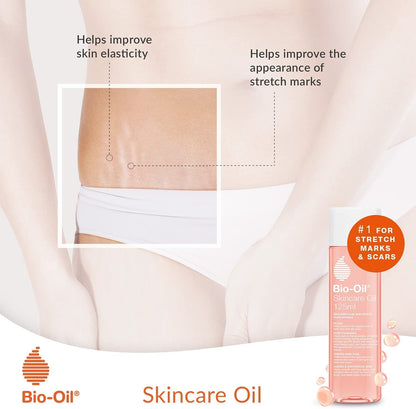 Bio-Oil Skincare Oil - Improve the Appearance of Scars, Stretch Marks and Skin Tone