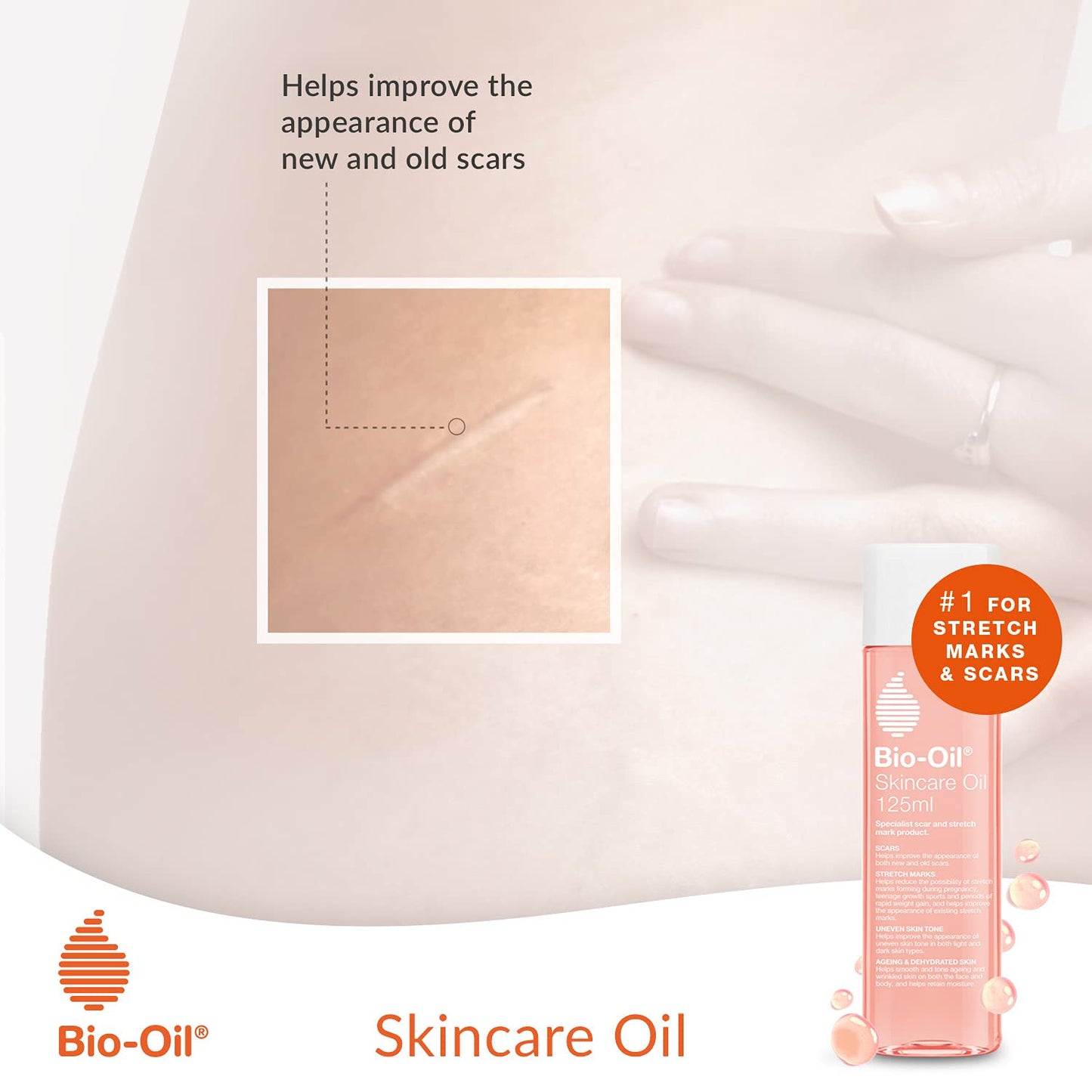 Bio-Oil Skincare Oil - Improve the Appearance of Scars, Stretch Marks and Skin Tone - 1 x 125 ml