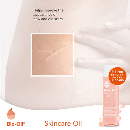 Bio-Oil Skincare Oil - Improve the Appearance of Scars, Stretch Marks and Skin Tone