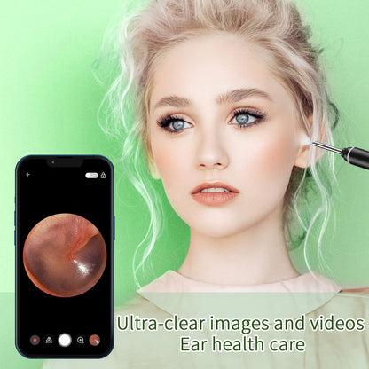 VITCOCO Ear Wax Removal Kit with 1920P HD Camera – Visual Ear Cleaner Otoscope with 6 LED Lights, 3mm Lens, Ear Cleaning Tool for iPhone, iPad & Android