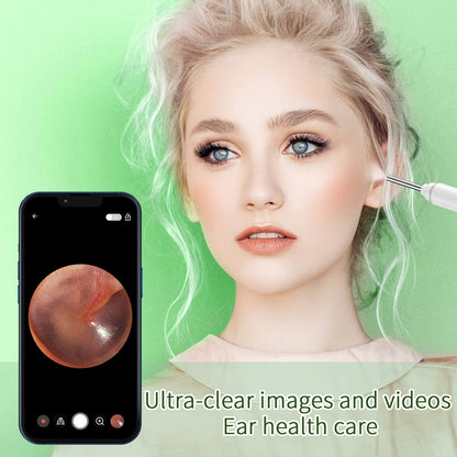 VITCOCO Ear Wax Removal Kit with 1920P HD Camera – Visual Ear Cleaner Otoscope with 6 LED Lights, 3mm Lens, Ear Cleaning Tool for iPhone, iPad & Android