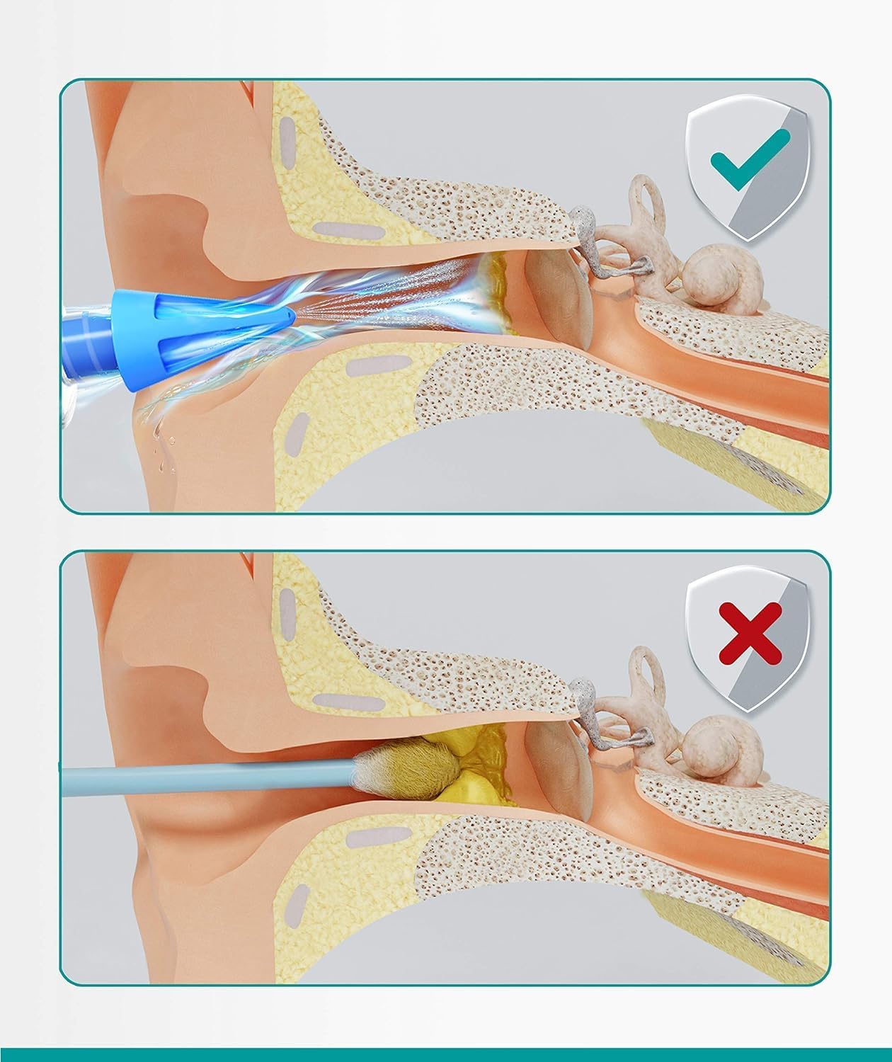 Medi Grade Ear Wax Removal Syringe - Natural Ear Cleaner for Safely Removing Ear Wax at Home - Reusable Ear Cleaning Kit with 3x Family Quad-Spray Safety Tips for Ear Irrigation - Ear Wax Removal Tool