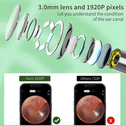 VITCOCO Ear Wax Removal Kit with 1920P HD Camera – Visual Ear Cleaner Otoscope with 6 LED Lights, 3mm Lens, Ear Cleaning Tool for iPhone, iPad & Android